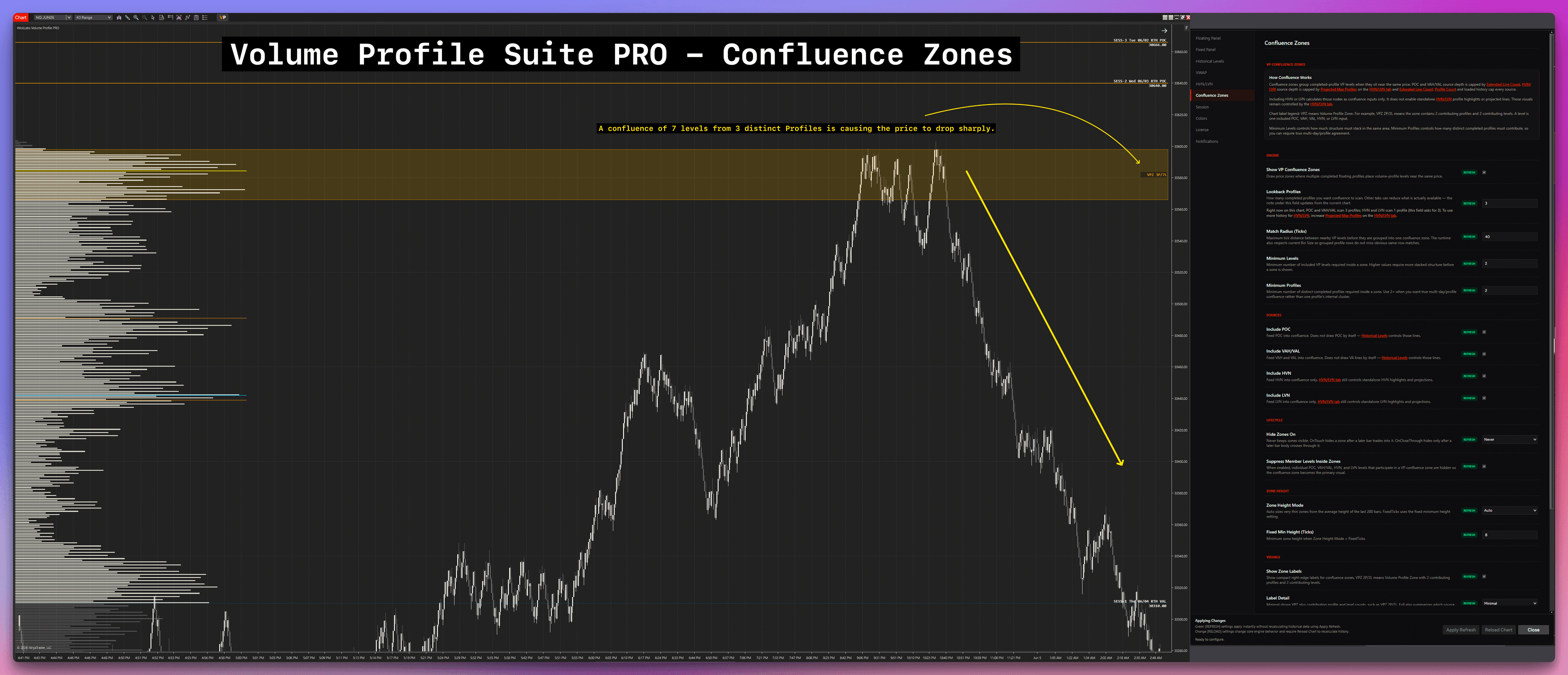 Volume Profile Suite PRO VP Confluence Zones highlighting multi-profile level agreement